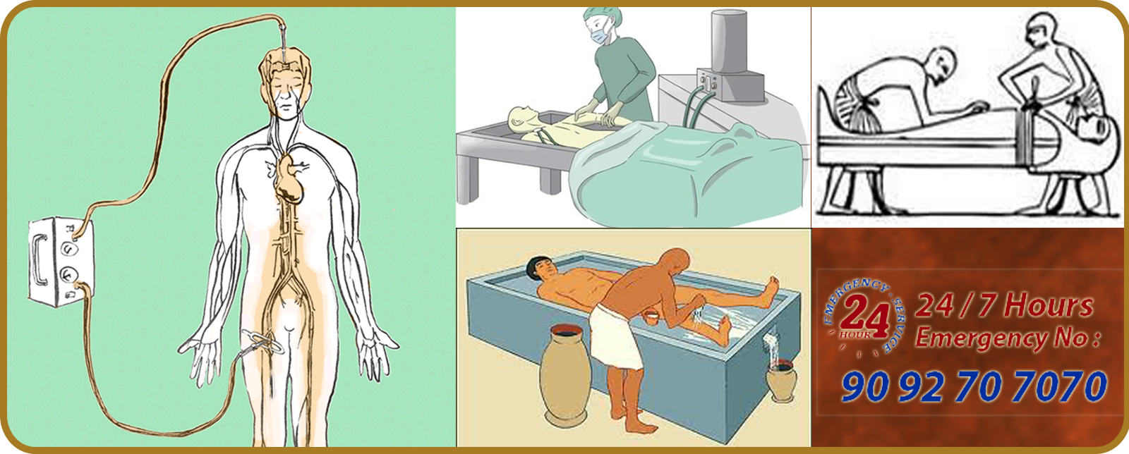 Body Embalming Services in Chennai